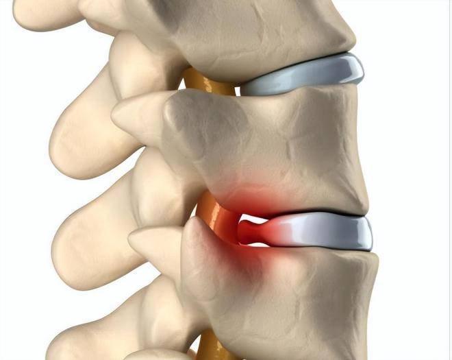 腰痛是什么原因？